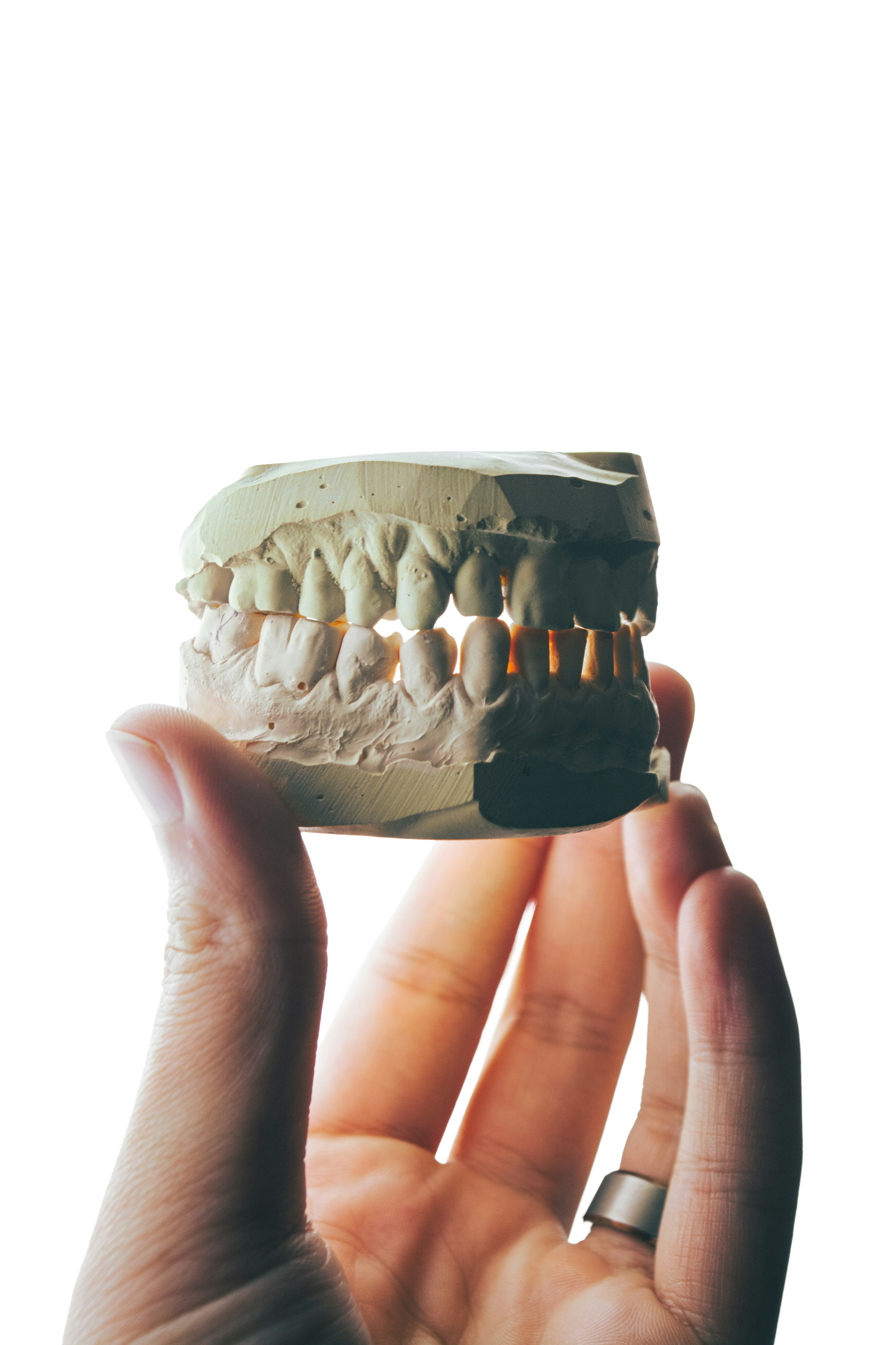 Modelo dental sostenido en mano
